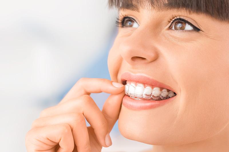Invisalign in McKinney