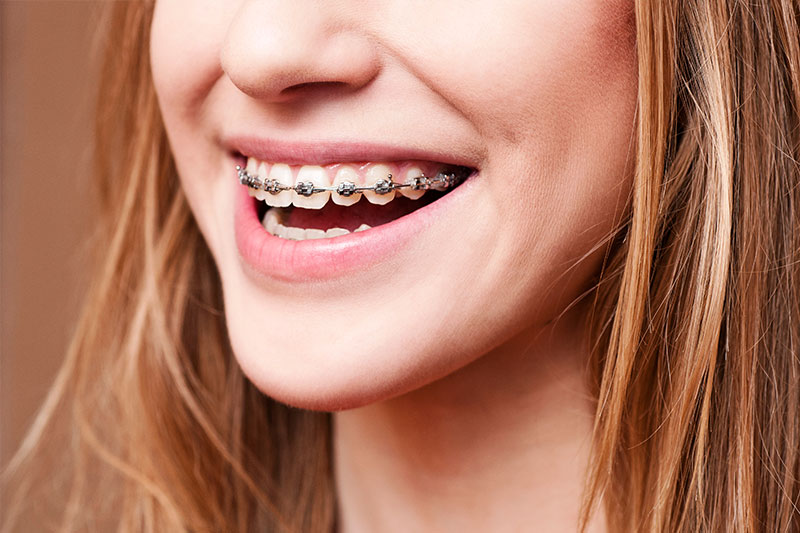 Emergency Dentist in McKinney