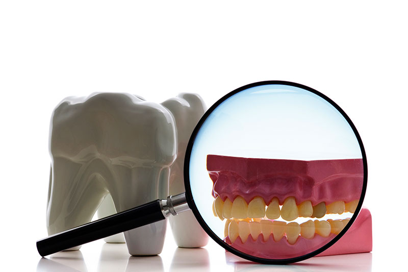 Root Canal in McKinney